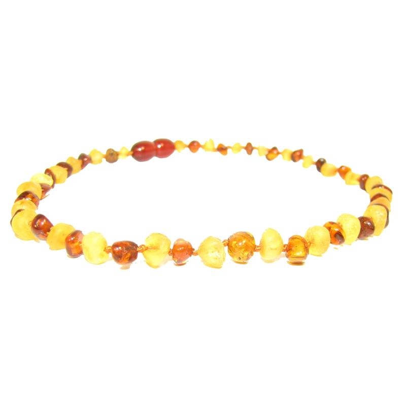 The Amber Monkey – Baroque Baltic Amber 12-13 inch Necklace, Raw Lemon/Polished Cognac POP